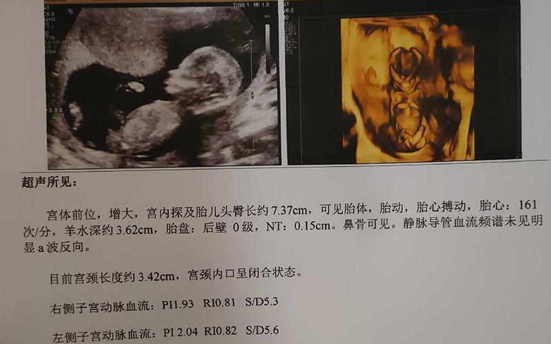 上海试管供卵生男孩(上海试管供卵生男孩：科技带来的新生命奇迹)